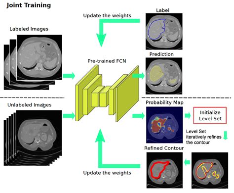 Conditional Random Fields) to incorporate connectivity constraints into the resulting masks. . Medical image segmentation post processing